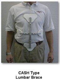 lumbar-barces-img